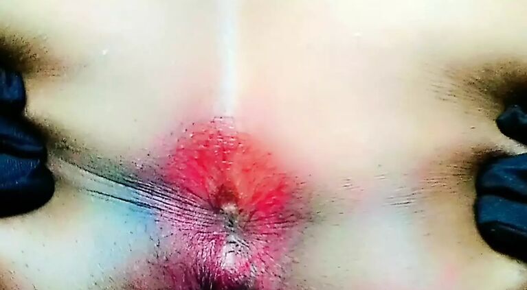 Pink Ass Hole Close up and huge ass
