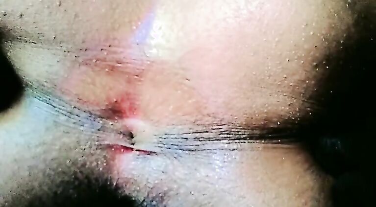 Pink Ass Hole Close up and huge ass